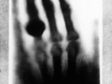 primeiro raio X